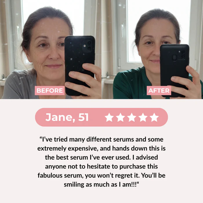 PDRN Pink Collagen Exosome Shot Serum